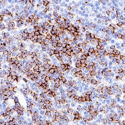 Human CD8 alpha Antibody, R D Systems 100 &mu;g; Unconjgated:Antibodies,