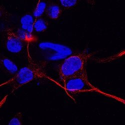 Human CD83 Antibody, R D Systems 500ug; Unlabeled:Antibodies, Monoclonal