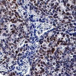 Human CDX2 Antibody, R D Systems 100&mu;g; Unlabeled:Antibodies, Monoclonal