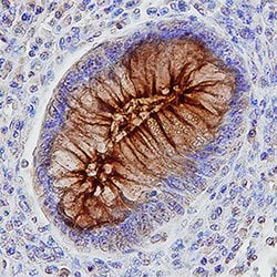 Human CEACAM-5/CD66e Antibody, R D Systems 100ug; Unlabeled:Antibodies,