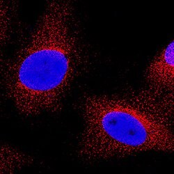 Human COX-2 Antibody, R D Systems 100ug; Unlabeled:Antibodies, Monoclonal
