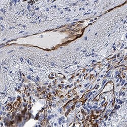 Human CRLR Antibody, R D Systems 25 &mu;g; Unconjgated:Antibodies, Monoclonal