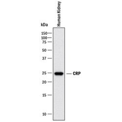 Human C-Reactive Protein/CRP Antibody, R D Systems:Antibodies:Primary Antibodies