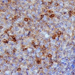 Human CXCR5 Antibody, R D Systems:Antibodies:Primary Antibodies
