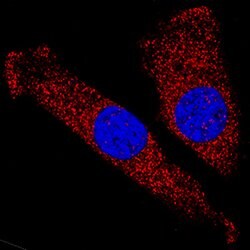 Human/Mouse/Rat CaM Kinase II Pan Specific Antibody, R D Systems 100&mu;g:Antibodies,
