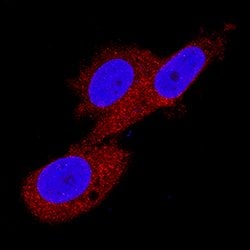 Human/Mouse/Rat CaM Kinase II Pan Specific Antibody, R D Systems 100&mu;g:Antibodies,