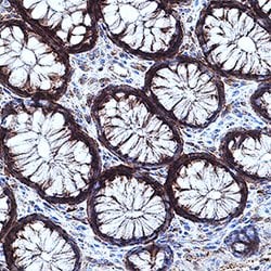 Human/Mouse/Rat CaM Kinase II Pan Specific Antibody, R D Systems 100&mu;g:Antibodies,