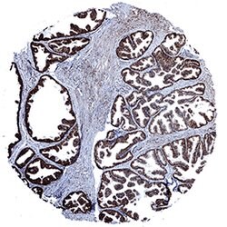 Human Calreticulin Antibody, R D Systems:Antibodies:Primary Antibodies