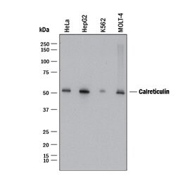 Human Calreticulin Antibody, R D Systems:Antibodies:Primary Antibodies