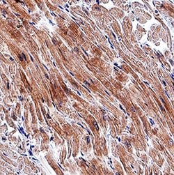 Human Cardiotrophin-1/CT-1 Antibody, R D Systems:Antibodies:Primary Antibodies