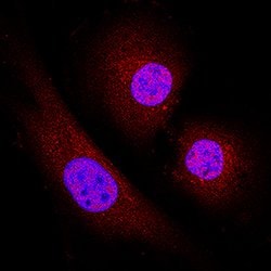 Human/Mouse/Rat Casein Kinase 1 delta Antibody, R D Systems 100&mu;g; Unlabeled:Antibodies,