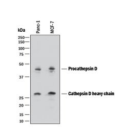 Human Cathepsin D Antibody, R D Systems 25&mu;g; Unlabeled:Antibodies,