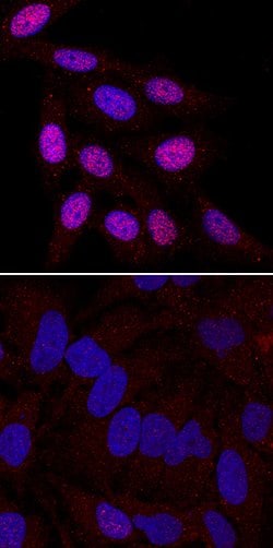 Human Phospho-Chk2 (T68) Antibody, R D Systems:Antibodies:Primary Antibodies