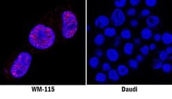 Human Cyclin D1 Antibody, R D Systems 25 &mu;g; Unconjgated:Antibodies,