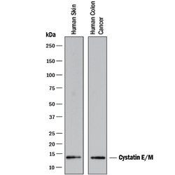 Human Cystatin E/M Antibody, R D Systems 500ug; Unlabeled:Antibodies, Monoclonal