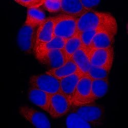 Human Cytokeratin 19 Antibody, R D Systems:Antibodies:Primary Antibodies