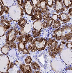 Human Cytokeratin 19 Antibody, R D Systems:Antibodies:Primary Antibodies