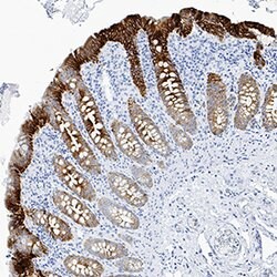 Human Cytokeratin 19 Antibody, R D Systems:Antibodies:Primary Antibodies