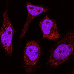 Human/Mouse/Rat DDX1 Antibody, R D Systems 25&mu;g:Antibodies, Monoclonal