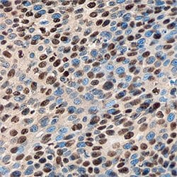 Human DEK Antibody, R D Systems 100ug; Unlabeled:Antibodies, Monoclonal