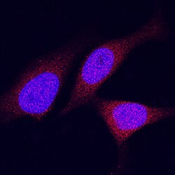 Human DPP9 Antibody, R D Systems 100&mu;g:Antibodies, Monoclonal