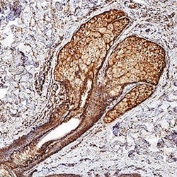 Human/Mouse Desmocollin-1 Antibody, R D Systems 100ug; Unlabeled:Antibodies,