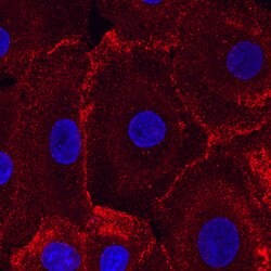 Human Desmoglein-2 Antibody, R D Systems 25&mu;g; Unlabeled:Antibodies,