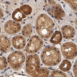 Human Dkk-2 Antibody, R D Systems:Antibodies:Primary Antibodies