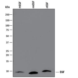 Human EGF Antibody, R D Systems 25&mu;g; Unlabeled:Antibodies, Polyclonal