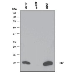 Human EGF Antibody, R D Systems:Antibodies:Primary Antibodies