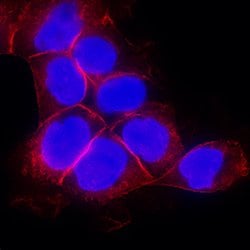 Human EGFR Antibody, R D Systems 100&mu;g; Unlabeled:Antibodies, Polyclonal