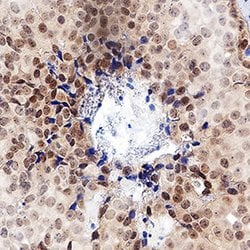 Human ER alpha/NR3A1 Antibody, R D Systems ER alpha/NR3A1 Antibody; Unconjugated;