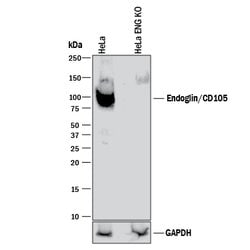 Human Endoglin/CD105 Antibody, R D Systems 100&mu;g; Unlabeled:Antibodies,