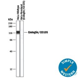 Human Endoglin/CD105 Antibody, R D Systems 100&mu;g; Unlabeled:Antibodies,