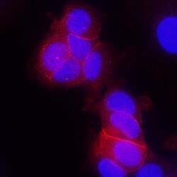 Human ErbB4/Her4 Antibody, R D Systems 500ug; Unlabeled:Antibodies, Monoclonal