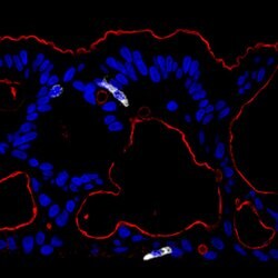 Human/Mouse/Rat Ezrin Antibody, R D Systems 100&mu;g; Unlabeled:Antibodies,