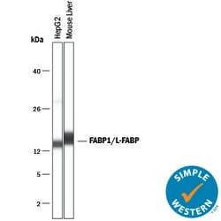 Human/Mouse/Rat FABP1/L-FABP Antibody, R D Systems 100ug; Unlabeled:Antibodies,