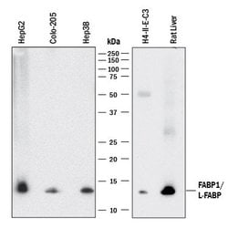 Human/Rat FABP1/L-FABP Antibody, R D Systems 100&mu;g:Antibodies, Monoclonal