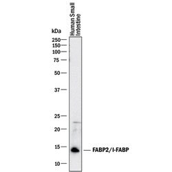 Human FABP2/I-FABP Antibody, R D Systems 100&mu;g; Unlabeled:Anticorps,