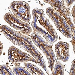 Human/Mouse FABP2/I-FABP Antibody, R D Systems:Antibodies:Primary Antibodies