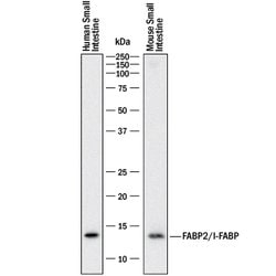 Human/Mouse FABP2/I-FABP Antibody, R D Systems:Antibodies:Primary Antibodies