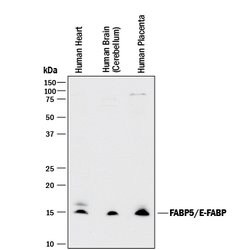 Human FABP5/E-FABP Antibody, R D Systems 25&mu;g; Unlabeled:Antibodies,