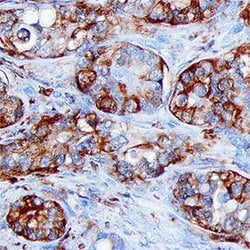 Human/Mouse/Rat FBPase 1 Antibody, R D Systems 100&mu;g; Unlabeled:Antibodies,