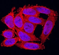 Human FGF-20 Antibody, R D Systems:Antibodies:Primary Antibodies