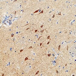 Human/Mouse/Rat FKBP12.6 Antibody, R D Systems 25&mu;g; Unlabeled:Antibodies,