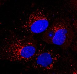 Human Ferritin Antibody, R D Systems:Antibodies:Primary Antibodies