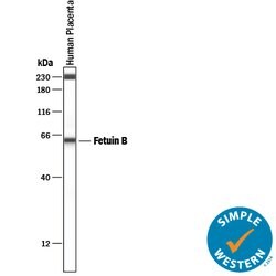 Human Fetuin B Antibody, R D Systems 25&mu;g; Unlabeled:Antibodies, Monoclonal