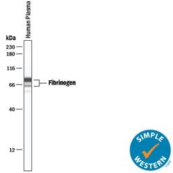 Human Fibrinogen Antibody, R D Systems 100&mu;g; Unlabeled:Antibodies,