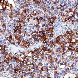 Human Fibrinogen A Antibody, R D Systems:Antibodies:Primary Antibodies