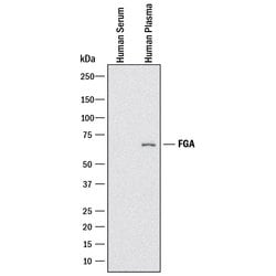 Human Fibrinogen A Antibody, R D Systems:Antibodies:Primary Antibodies